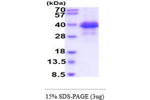 FCER2 Protein (AA 48-321) (His tag)