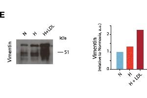 Western Blotting (WB) image for anti-Vimentin (VIM) antibody (ABIN2854814)