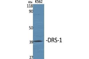 Western Blot (WB) analysis of specific cells using DRS-1 Polyclonal Antibody. (DDX27 抗体  (Internal Region))