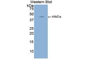 Western blot analysis of the recombinant protein. (NPPA 抗体  (AA 25-152))