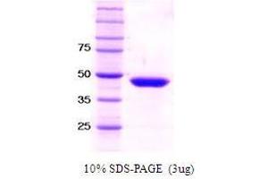 Figure annotation denotes ug of protein loaded and % gel used. (SET7/9 蛋白)