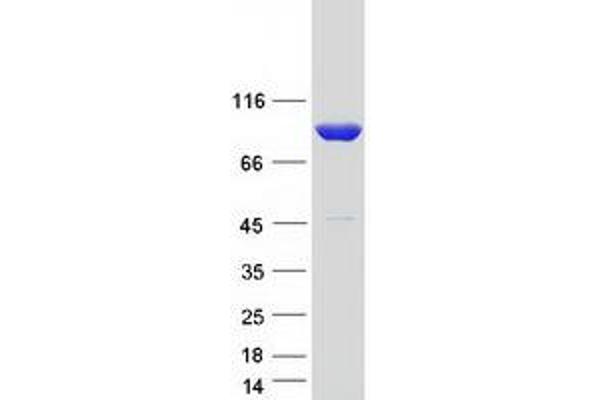 CARS Protein (Transcript Variant 3) (Myc-DYKDDDDK Tag)