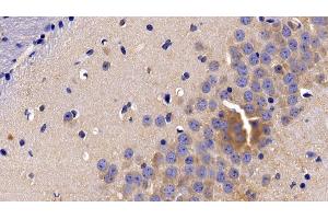 Detection of TNFR1 in Mouse Cerebrum Tissue using Polyclonal Antibody to Tumor Necrosis Factor Receptor 1 (TNFR1) (TNFRSF1A 抗体  (AA 239-433))