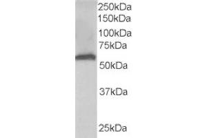 Image no. 2 for anti-Formiminotransferase Cyclodeaminase (FTCD) (N-Term) antibody (ABIN374453) (FTCD 抗体  (N-Term))