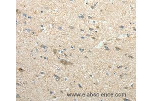 Immunohistochemistry of Human brain using SIRT3 Polyclonal Antibody at dilution of 1:30 (SIRT3 抗体)