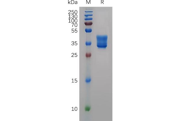 HCST Protein (AA 19-48) (Fc Tag)