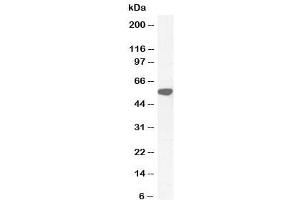 Western blot testing of human testis lysate with KATNAL2 antibody at 0. (KATNAL2 抗体)