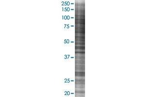 Western Blotting (WB) image for UMOD 293T Cell Transient Overexpression Lysate(Denatured) (ABIN1333855)