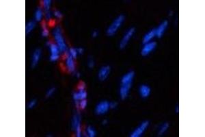 Immunofluorescence analysis of Mouse heart tissue using α-SMA Polyclonal Antibody at dilution of 1:200. (alpha-SMA 抗体)