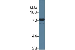 Detection of ENG in Human Lung lysate using Monoclonal Antibody to Endoglin (ENG) (Endoglin 抗体  (AA 26-136))