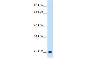 KLK-B1 antibody used at 2. (KLK-B1 抗体)