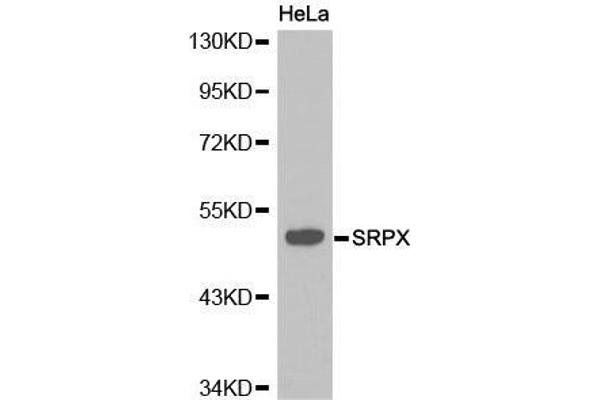SRPX 抗体  (AA 40-320)