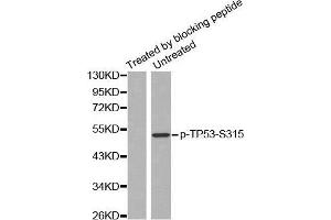 Western blot analysis of extracts from Hela cells, using Phospho-TP53-S315 antibody. (p53 抗体  (pSer315))