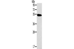 Western Blotting (WB) image for anti-Histamine Receptor H1 (HRH1) antibody (ABIN2434779) (HRH1 抗体)