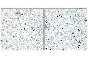 Immunohistochemistry (IHC) image for anti-Tripartite Motif Containing 24 (TRIM24) (C-Term) antibody (ABIN1848954) (TRIM24 抗体  (C-Term))