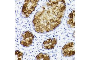Immunohistochemistry of paraffin-embedded human colon using TFF3 Rabbit mAb (ABIN1680916, ABIN3019077, ABIN3019078 and ABIN7101711) at dilution of 1:100 (40x lens). (TFF3 抗体)