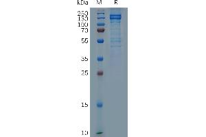 E-cadherin Protein (AA 23-706) (mFc Tag)