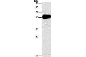 Western blot analysis of Mouse pancreas tissue, using AMY2A Polyclonal Antibody at dilution of 1:1550 (AMY2A 抗体)