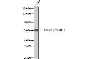 Western blot analysis of extracts of Jurkat cells, using TRK fused gene (TFG) (TFG) Rabbit mAb (ABIN1512690, ABIN3022090, ABIN3022091 and ABIN7101442) at 1:3000 dilution. (TFG 抗体)