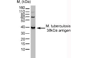 Western Blotting (WB) image for anti-Mycobacterium Tuberculosis antibody (ABIN2475767) (M. tuberculosis 抗体)