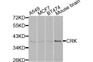 Western blot analysis of extracts of various cell lines, using CRK antibody (ABIN5975327) at 1/1000 dilution. (Crk 抗体)