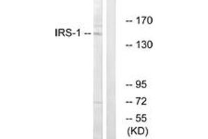 Western blot analysis of extracts from NIH-3T3 cells, using IRS-1 (Ab-312) Antibody. (IRS1 抗体  (AA 279-328))