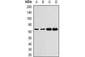 Western blot analysis of G6PD expression in A549 (A), HT29 (B), K562 (C), mouse spleen (D) whole cell lysates. (Glucose-6-Phosphate Dehydrogenase 抗体)