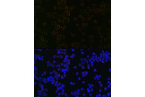 Immunofluorescence analysis of Raw264 7 cells using iNOS Rabbit mAb (ABIN1678965, ABIN3018084, ABIN3018085 and ABIN7101575) at dilution of 1:100 (40x lens). (NOS2 抗体)