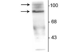 Western blot of T47D cell lysate prepared from cells that had been incubated in the presence of the synthetic progestin agonist R5020 (500 nM) showing specific immunolabeling of the ~90 kDa PR-A isoform and the ~120 kDa PR-B isoform of the progesterone receptor phosphorylated at Ser190. (Progesterone Receptor 抗体  (pSer190))
