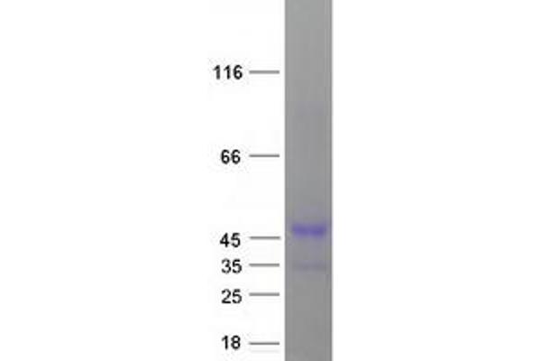 Cyclin Y Protein (CCNY) (Transcript Variant 1) (Myc-DYKDDDDK Tag)