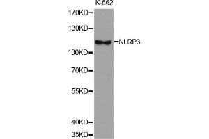 Western Blotting (WB) image for anti-NLR Family, Pyrin Domain Containing 3 (NLRP3) antibody (ABIN1876853) (NLRP3 抗体)