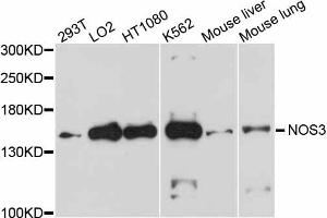 Western blot analysis of extracts of various cell lines, using NOS3 antibody. (ENOS 抗体)