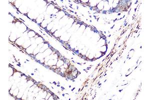 Immunohistochemistry of paraffin-embedded human colon using FHL1 Rabbit mAb (ABIN1680536, ABIN3019332, ABIN3019333 and ABIN7101753) at dilution of 1:100 (40x lens). (FHL1 抗体)
