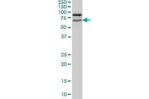 Western Blotting (WB) image for anti-Nucleolar and Coiled-Body Phosphoprotein 1 (NOLC1) (AA 590-700) antibody (ABIN598599) (NOLC1 抗体  (AA 590-700))