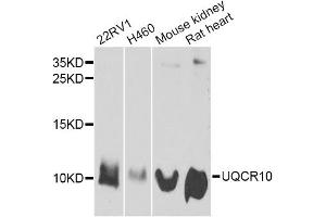 Western blot analysis of extracts of various cell lines, using UQCR10 antibody (ABIN6293712) at 1:1000 dilution. (UQCR10 抗体)