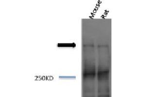 Piccolo Western Blot. (PCLO 抗体)