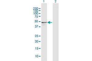 Western Blot analysis of NAPRT1 expression in transfected 293T cell line by NAPRT1 MaxPab polyclonal antibody. (NAPRT1 抗体  (AA 1-466))