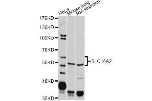 Western blot analysis of extracts of various cell lines, using SLC18A2 antibody. (SLC18A2 抗体)