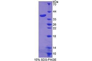 SDS-PAGE analysis of Human GLVR1 Protein. (SLC20A1 蛋白)