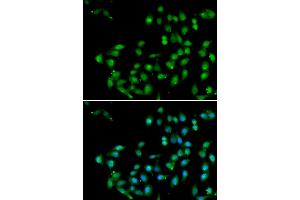Immunofluorescence analysis of U20S cell using CTNNBL1 antibody. (CTNNBL1 抗体)