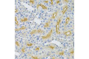 Immunohistochemistry of paraffin-embedded rat kidney using UBE2B Antibody. (UBE2B 抗体)