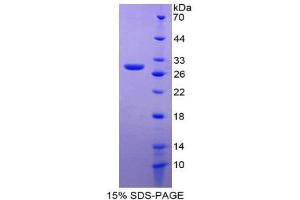 SDS-PAGE (SDS) image for delta-Like 1 Homolog (Drosophila) (DLK1) (AA 81-311) protein (His tag) (ABIN1981231) (DLK1 Protein (AA 81-311) (His tag))