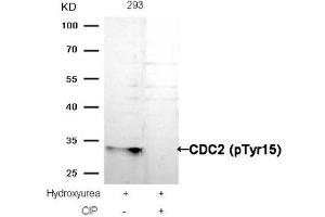 Western blot analysis of extracts from 293 cells, treated with Hydroxyurea or calf intestinal phosphatase (CIP), using CDC2 (Phospho-Tyr15) Antibody. (CDK1 抗体  (pTyr15))