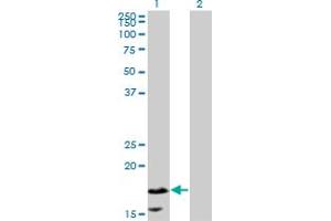 Western Blot analysis of CALML5 expression in transfected 293T cell line by CALML5 monoclonal antibody (M16), clone 2F10. (CALML5 抗体  (AA 1-146))