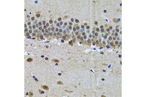 Immunohistochemistry of paraffin-embedded mouse brain using SPIN1 antibody. (Spindlin 1 抗体  (AA 1-262))