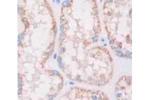 IHC-P analysis of Kidney tissue, with DAB staining. (HSD17B12 抗体  (AA 1-312))