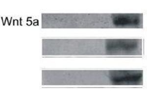 Western Blotting (WB) image for anti-Wingless-Type MMTV Integration Site Family, Member 5A (WNT5A) (AA 301-381) antibody (ABIN675758)