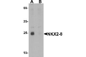 Western blot analysis of NKX2-8 in rat liver tissue lysate with NKX2-8 antibody at 1 µg/mL in (A) the absence and (B) the presence of blocking peptide (NKX2-8 抗体  (Middle Region))