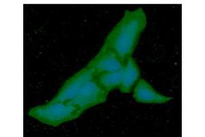 ICC/IF analysis of PGM1 in HeLa cells line, stained with DAPI (Blue) for nucleus staining and monoclonal anti-human PGM1 antibody (1:100) with goat anti-mouse IgG-Alexa fluor 488 conjugate (Green). (Phosphoglucomutase 1 抗体)