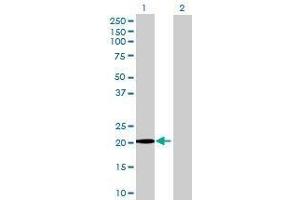 Lane 1: RNF185 transfected lysate ( 21. (RNF185 293T Cell Transient Overexpression Lysate(Denatured))